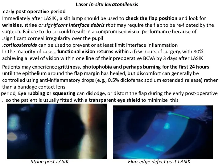 Laser in-situ keratomileusis early post-operative period Immediately after LASIK ,