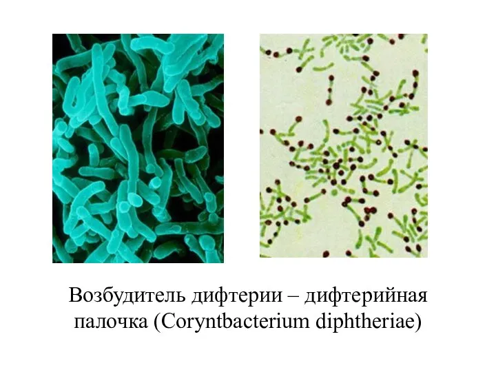 Возбудитель дифтерии – дифтерийная палочка (Coryntbacterium diphtheriae)