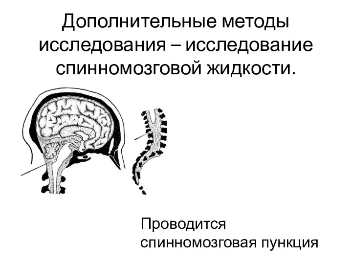 Дополнительные методы исследования – исследование спинномозговой жидкости. Проводится спинномозговая пункция