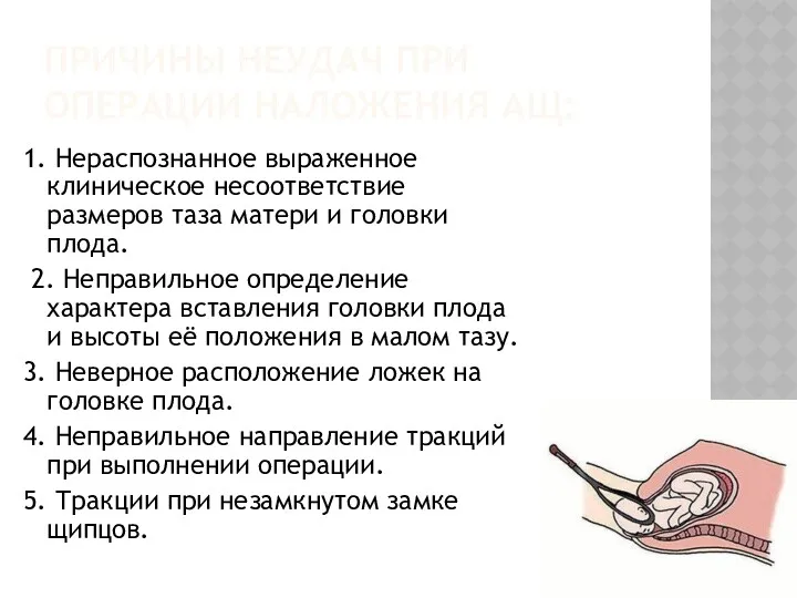 ПРИЧИНЫ НЕУДАЧ ПРИ ОПЕРАЦИИ НАЛОЖЕНИЯ АЩ: 1. Нераспознанное выраженное клиническое