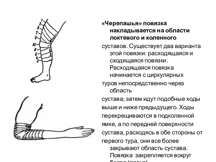 «Черепашья» повязка накладывается на области локтевого и коленного суставов. Существует два варианта этой