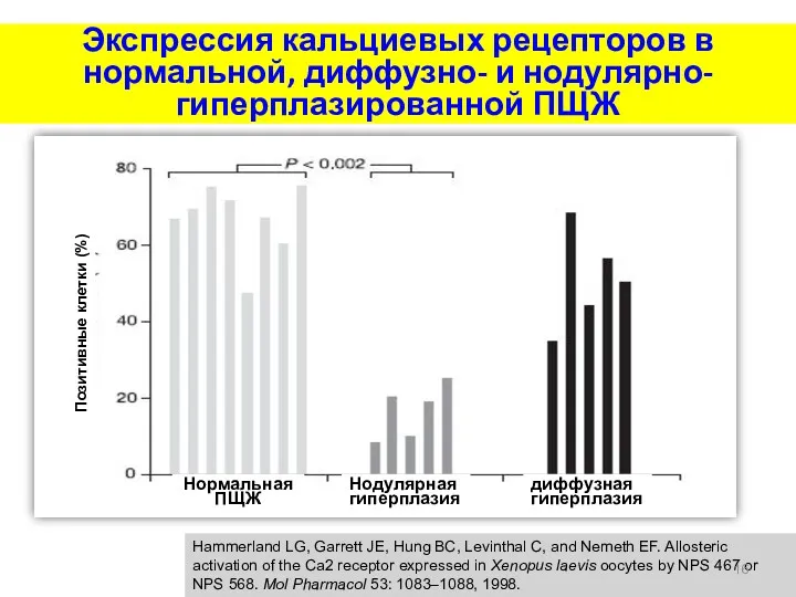 Экспрессия кальциевых рецепторов в нормальной, диффузно- и нодулярно-гиперплазированной ПЩЖ Hammerland