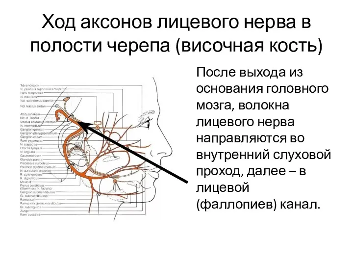 Ход аксонов лицевого нерва в полости черепа (височная кость) После