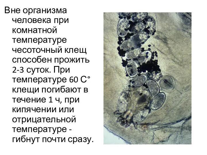 Вне организма человека при комнатной температуре чесоточный клещ способен прожить