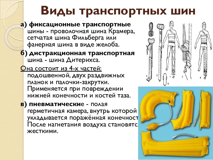 Виды транспортных шин а) фиксационные транспортные шины - проволочная шина