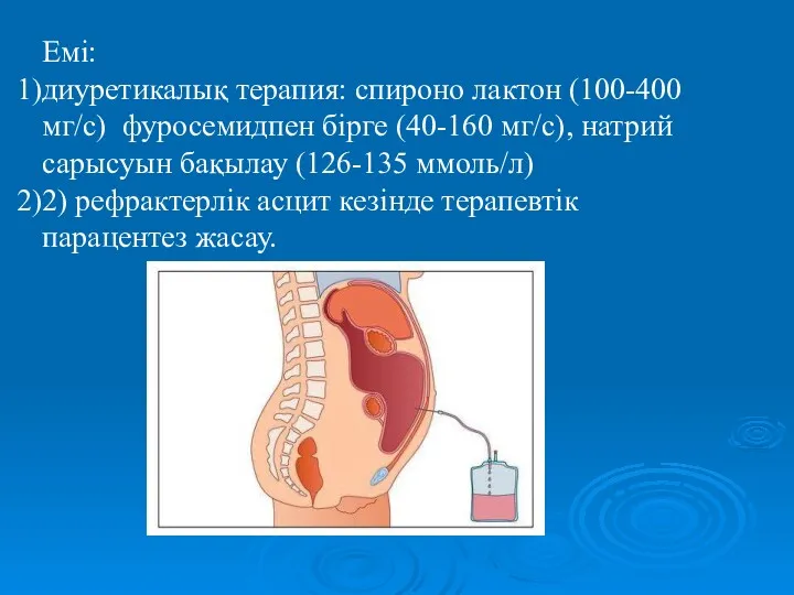 Емі: диуретикалық терапия: спироно лактон (100-400 мг/с) фуросемидпен бірге (40-160