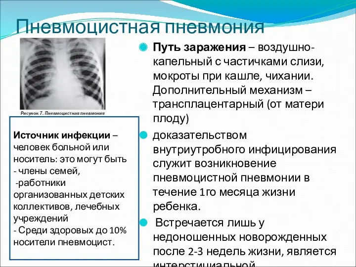 Пневмоцистная пневмония Путь заражения – воздушно-капельный с частичками слизи, мокроты