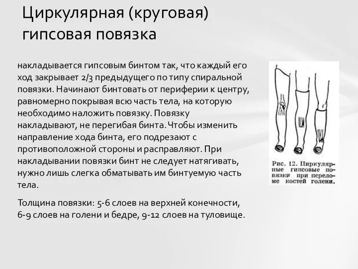 накладывается гипсовым бинтом так, что каждый его ход закрывает 2/3