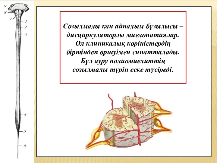 Созылмалы қан айналым бұзылысы – дисциркуляторлы миелопатиялар. Ол клиникалық көріністердің