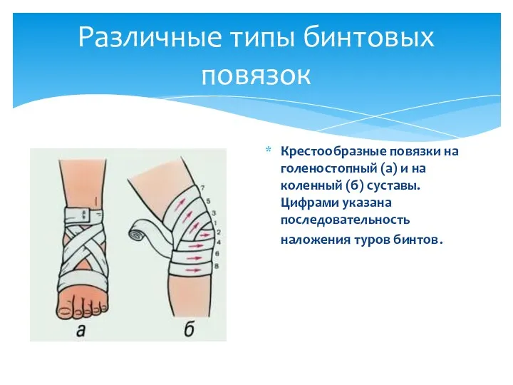Крестообразные повязки на голеностопный (а) и на коленный (б) суставы. Цифрами указана последовательность