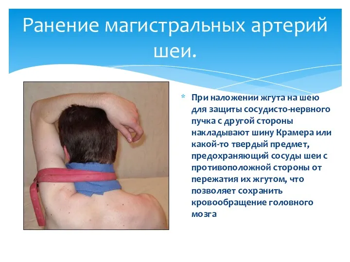 При наложении жгута на шею для защиты сосудисто-нервного пучка с другой стороны накладывают