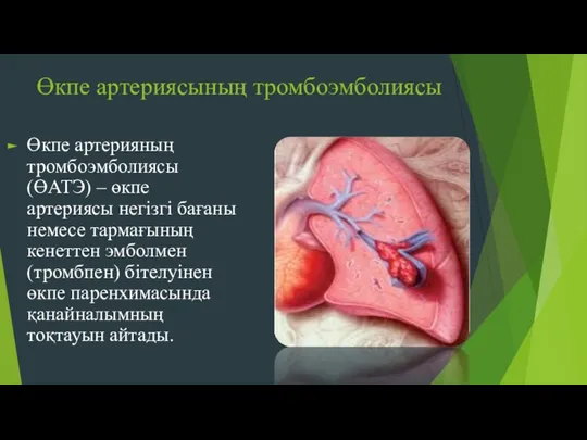 Өкпе артериясының тромбоэмболиясы Өкпе артерияның тромбоэмболиясы (ӨАТЭ) – өкпе артериясы
