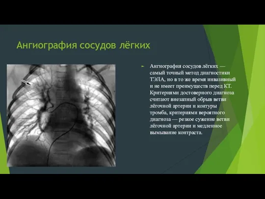 Ангиография сосудов лёгких Ангиография сосудов лёгких — самый точный метод