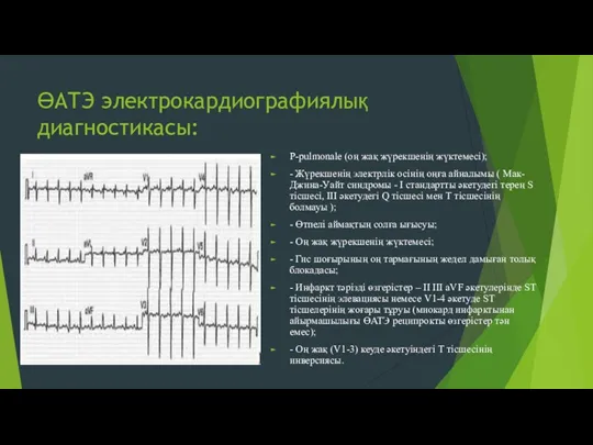 ӨАТЭ электрокардиографиялық диагностикасы: P-pulmonale (оң жақ жүрекшенің жүктемесі); - Жүрекшенің