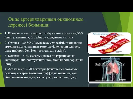 Өкпе артерияларының окклюзиясы дəрежесі бойынша: 1. Шамалы – қан тамыр