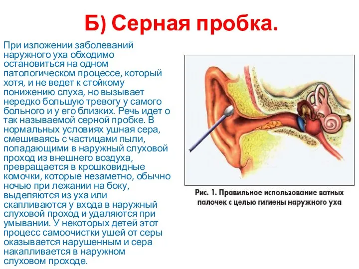 Б) Серная пробка. При изложении заболеваний наружного уха обходимо остановиться на одном патологическом
