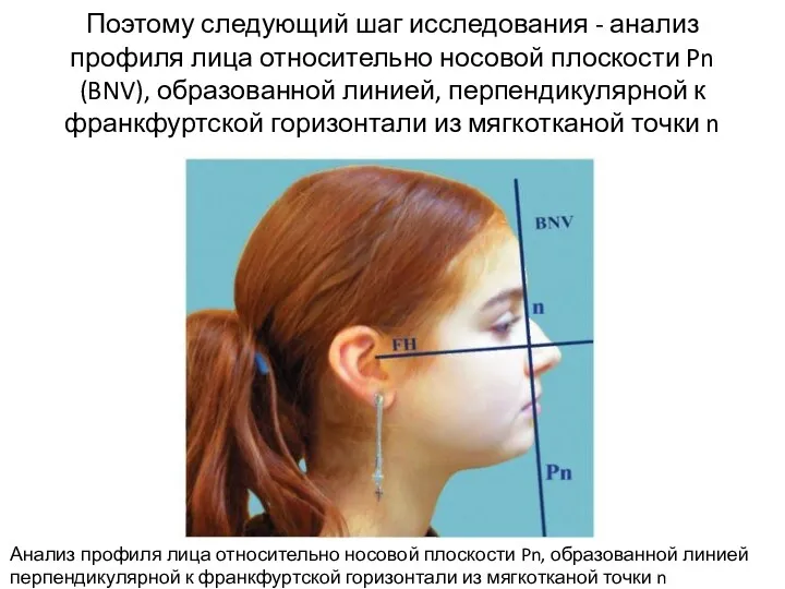 Поэтому следующий шаг исследования - анализ профиля лица относительно носовой