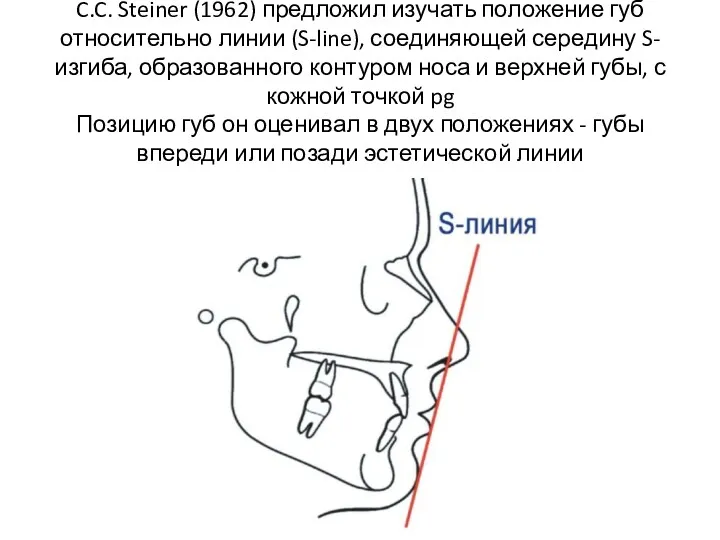 C.C. Steiner (1962) предложил изучать положение губ относительно линии (S-line),