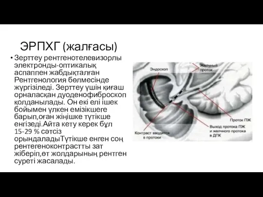 ЭРПХГ (жалғасы) Зерттеу рентгенотелевизорлы электронды-оптикалық аспаппен жабдықталған Рентгенология бөлмесінде жүргізіледі.