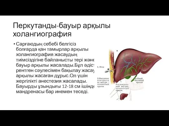 Перкутанды-бауыр арқылы холангиография Сарғаюдың себебі белгісіз болғарда қан тамырлар арқылы