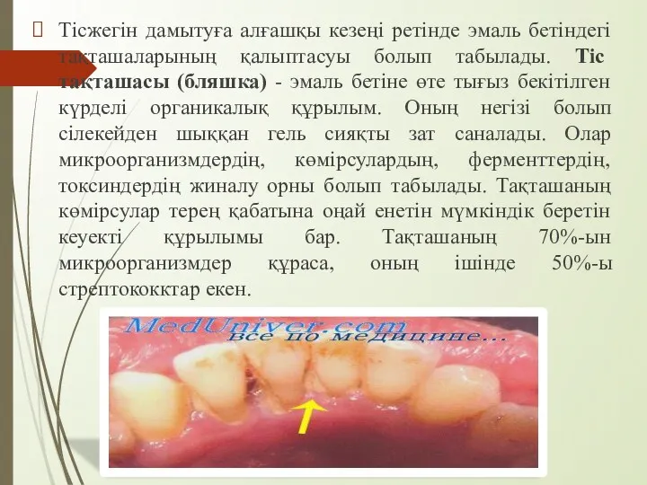 Тісжегін дамытуға алғашқы кезеңі ретінде эмаль бетіндегі тақташаларының қалыптасуы болып табылады. Тіс тақташасы