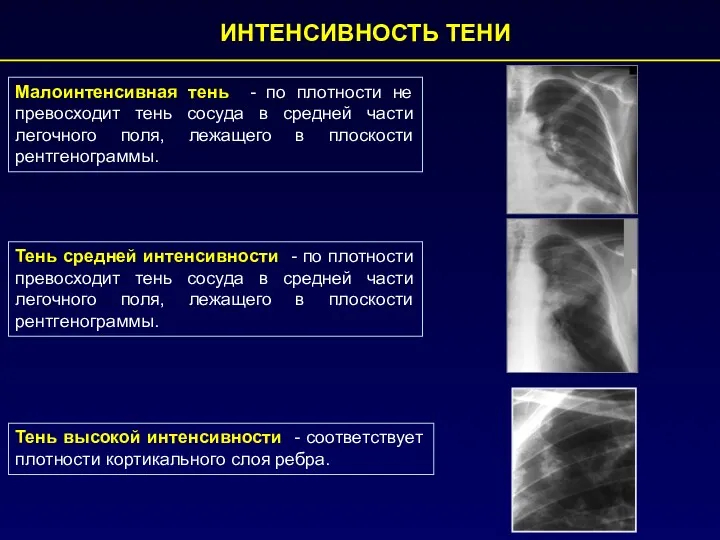 ИНТЕНСИВНОСТЬ ТЕНИ Малоинтенсивная тень - по плотности не превосходит тень