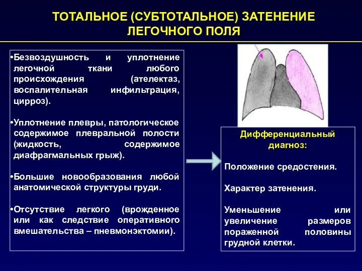 ТОТАЛЬНОЕ (СУБТОТАЛЬНОЕ) ЗАТЕНЕНИЕ ЛЕГОЧНОГО ПОЛЯ Безвоздушность и уплотнение легочной ткани