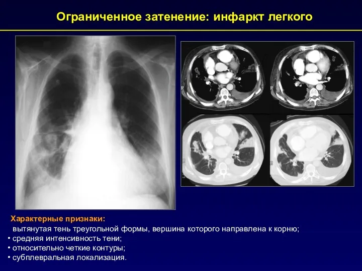 Характерные признаки: вытянутая тень треугольной формы, вершина которого направлена к