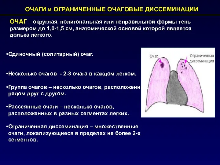 ОЧАГИ и ОГРАНИЧЕННЫЕ ОЧАГОВЫЕ ДИССЕМИНАЦИИ Одиночный (солитарный) очаг. Несколько очагов