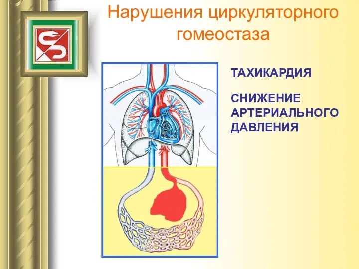 Нарушения циркуляторного гомеостаза ТАХИКАРДИЯ СНИЖЕНИЕ АРТЕРИАЛЬНОГО ДАВЛЕНИЯ