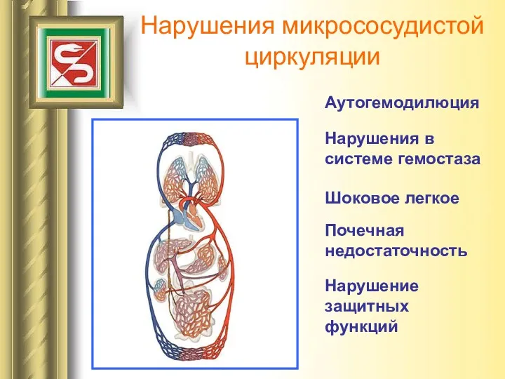 Нарушения микрососудистой циркуляции Аутогемодилюция Нарушения в системе гемостаза Шоковое легкое Нарушение защитных функций Почечная недостаточность