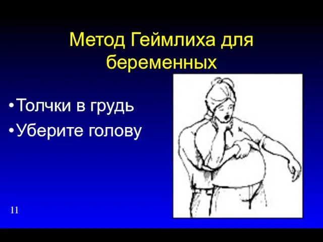 Метод Геймлиха для беременных Толчки в грудь Уберите голову