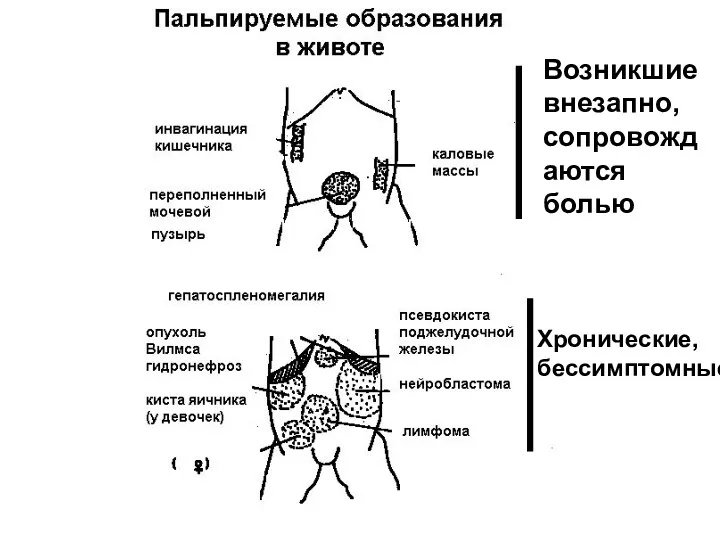 Возникшие внезапно, сопровождаются болью Хронические, бессимптомные