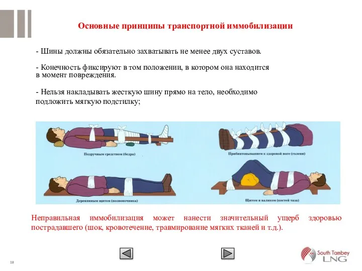 Основные принципы транспортной иммобилизации - Шины должны обязательно захватывать не