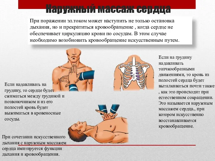 Наружный массаж сердца При поражении эл.током может наступить не только