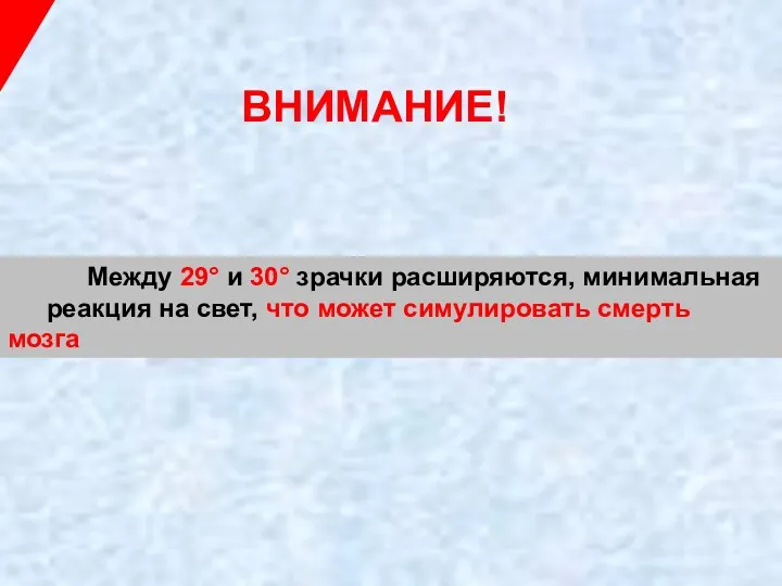 Между 29° и 30° зрачки расширяются, минимальная реакция на свет, что может симулировать смерть мозга ВНИМАНИЕ!