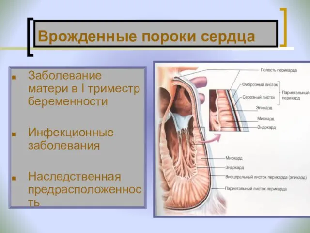 Врожденные пороки сердца Заболевание матери в I триместр беременности Инфекционные заболевания Наследственная предрасположенность