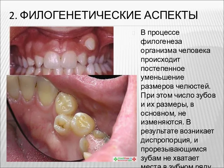 2. ФИЛОГЕНЕТИЧЕСКИЕ АСПЕКТЫ В процессе филогенеза организма человека происходит постепенное