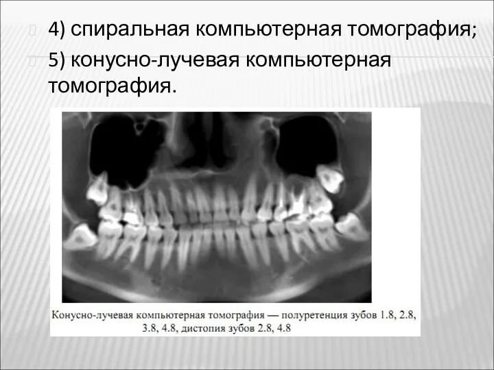 4) спиральная компьютерная томография; 5) конусно-лучевая компьютерная томография.