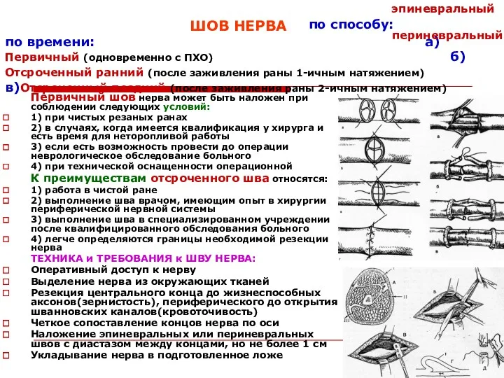 ШОВ НЕРВА по времени: а)Первичный (одновременно с ПХО) б)Отсроченный ранний