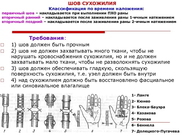 ШОВ СУХОЖИЛИЯ Классификация по времени наложения: первичный шов – накладывается