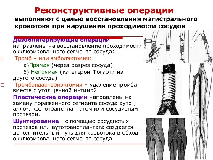 Реконструктивные операции выполняют с целью восстановления магистрального кровотока при нарушении