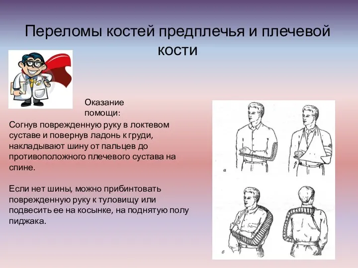 Переломы костей предплечья и плечевой кости Оказание помощи: Согнув поврежденную