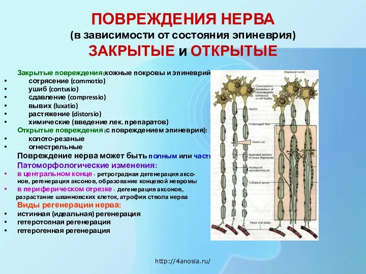 ПОВРЕЖДЕНИЯ НЕРВА (в зависимости от состояния эпиневрия) ЗАКРЫТЫЕ и ОТКРЫТЫЕ