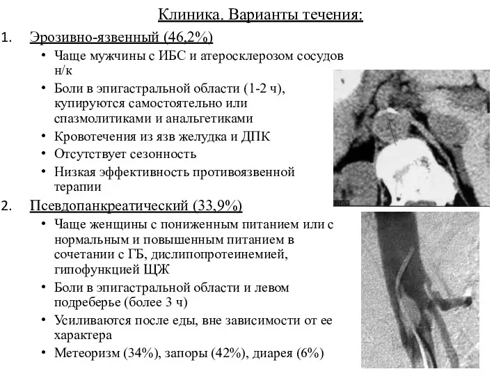 Клиника. Варианты течения: Эрозивно-язвенный (46,2%) Чаще мужчины с ИБС и