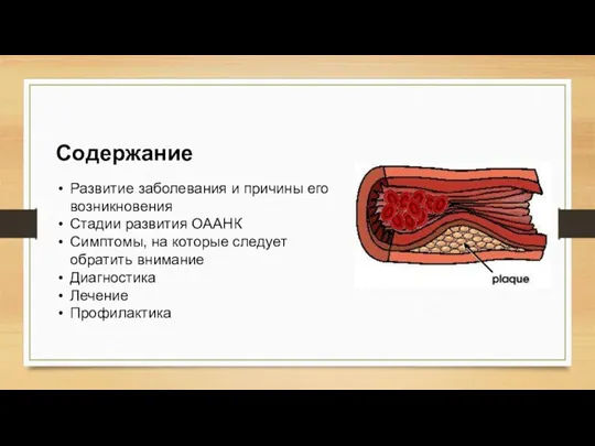 Содержание Развитие заболевания и причины его возникновения Стадии развития ОААНК Симптомы, на которые