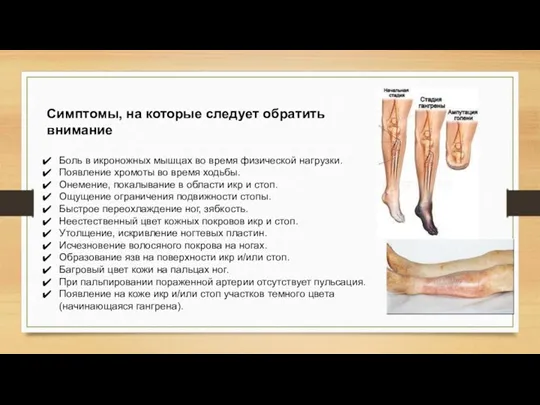 Симптомы, на которые следует обратить внимание Боль в икроножных мышцах