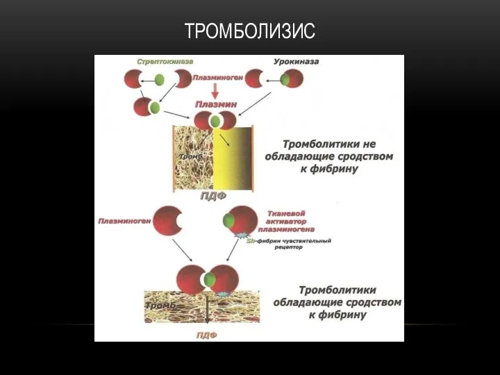 ТРОМБОЛИЗИС