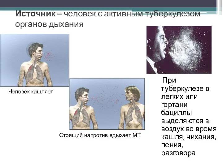 Источник – человек с активным туберкулезом органов дыхания При туберкулезе