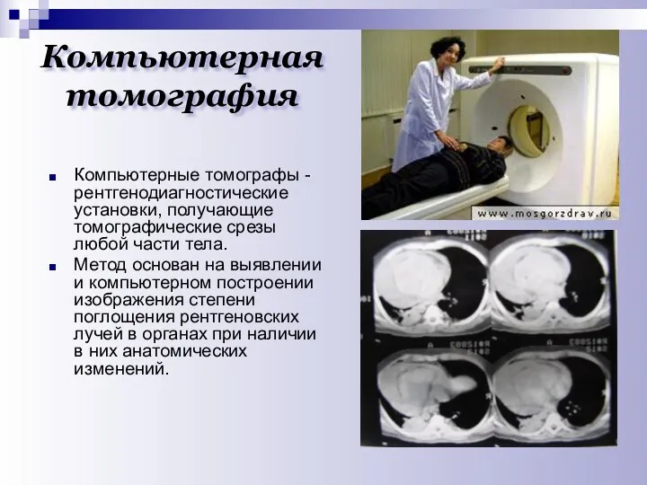 Компьютерная томография Компьютерные томографы - рентгенодиагностические установки, получающие томографические срезы